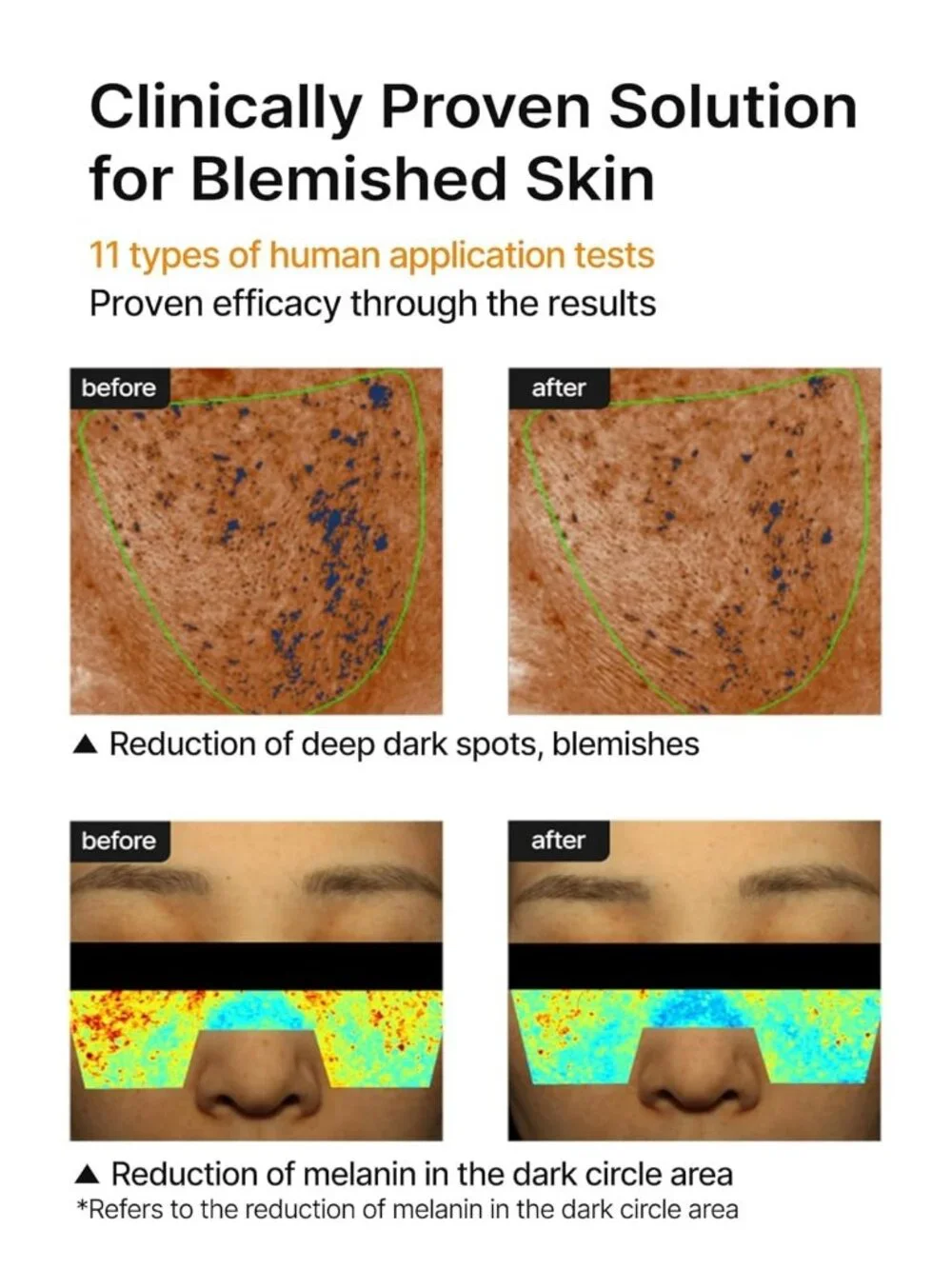 FREE W BUNDLE Celimax Pore Dark Spot Brightening Cream